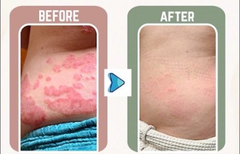 K. before and after